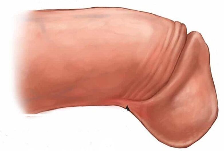 jak powiększyć żołądź prącia